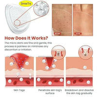 DermaSmooth Skin Tag Patches – Discreet Adhesive Patches (Pack of 24)
