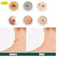 DermaSmooth Skin Tag Patches – Discreet Adhesive Patches (Pack of 24)